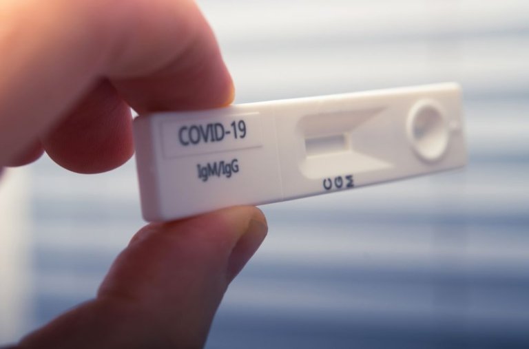 Covid 19’un biyokütleye etkisi